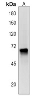 PKD2L2 Rabbit Polyclonal Antibody