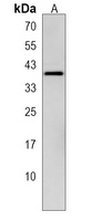 OR4X1 Rabbit Polyclonal Antibody
