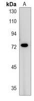 KIZ Rabbit Polyclonal Antibody