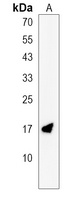 GABARAPL3 Rabbit Polyclonal Antibody