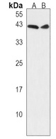 GIPC3 Rabbit Polyclonal Antibody