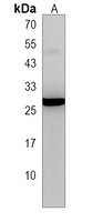SIRPD Rabbit Polyclonal Antibody