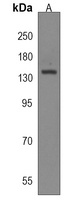CAMSAP3 Rabbit Polyclonal Antibody