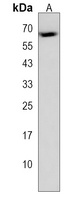 ZFP57 Rabbit Polyclonal Antibody