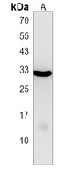 NKX6-2 Rabbit Polyclonal Antibody