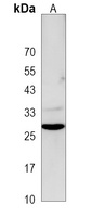 DRAM1 Rabbit Polyclonal Antibody