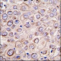 DRAM1 Rabbit Polyclonal Antibody