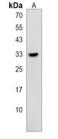 TIPRL Rabbit Polyclonal Antibody