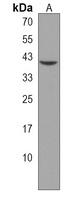 QPCTL Rabbit Polyclonal Antibody