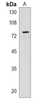 CRTAC1 Rabbit Polyclonal Antibody