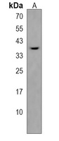PDLIM4 Rabbit Polyclonal Antibody
