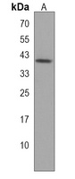 ZNF547 Rabbit Polyclonal Antibody