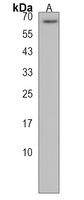 GALNT9 Rabbit Polyclonal Antibody