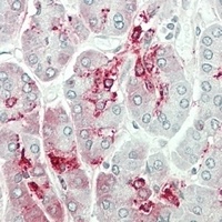 GALNT9 Rabbit Polyclonal Antibody
