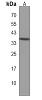 CPPED1 Rabbit Polyclonal Antibody