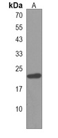 HOXB6 Rabbit Polyclonal Antibody
