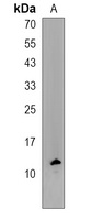 COA4 Rabbit Polyclonal Antibody