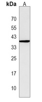 MTHFSD Rabbit Polyclonal Antibody
