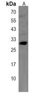 CRISP1 Rabbit Polyclonal Antibody