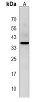 PBLD Antibody