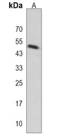 KCTD13 Rabbit Polyclonal Antibody