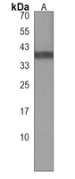 FEZ2 Rabbit Polyclonal Antibody
