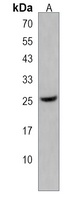 HMGN5 Rabbit Polyclonal Antibody