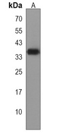 SBK2 Rabbit Polyclonal Antibody
