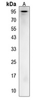 AP4B1 Rabbit Polyclonal Antibody