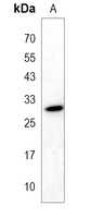 EPDR1 Rabbit Polyclonal Antibody
