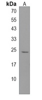 ANP32B Rabbit Polyclonal Antibody