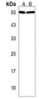 USP27X Rabbit Polyclonal Antibody