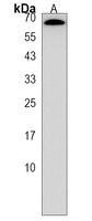 KLHL38 Rabbit Polyclonal Antibody