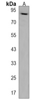 DSC3 Rabbit Polyclonal Antibody