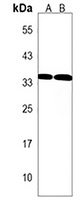 FRG1 Rabbit Polyclonal Antibody