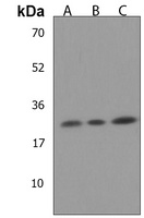 NKAIN2 Rabbit Polyclonal Antibody