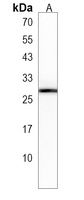 SYNGR2 Rabbit Polyclonal Antibody