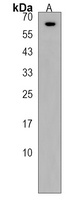 KLHL25 Rabbit Polyclonal Antibody