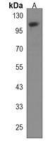 KIF18A Rabbit Polyclonal Antibody