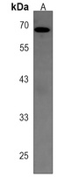 AIM1L Rabbit Polyclonal Antibody