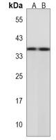 BOLL Rabbit Polyclonal Antibody