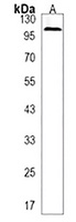 SMEK2 Rabbit Polyclonal Antibody