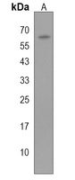 GJA8 Rabbit Polyclonal Antibody