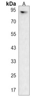 Plakophilin 3 Rabbit Polyclonal Antibody