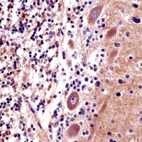 CDR2 Rabbit Polyclonal Antibody