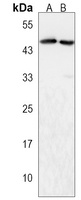 ZDHHC6 Rabbit Polyclonal Antibody