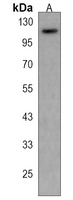 PCSK6 Rabbit Polyclonal Antibody