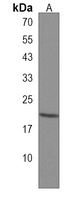 EMC4 Rabbit Polyclonal Antibody