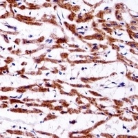 EMC4 Rabbit Polyclonal Antibody