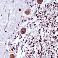 TRA2B Rabbit Polyclonal Antibody